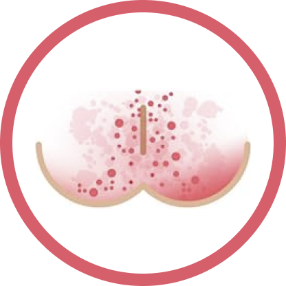 severe rash illustration